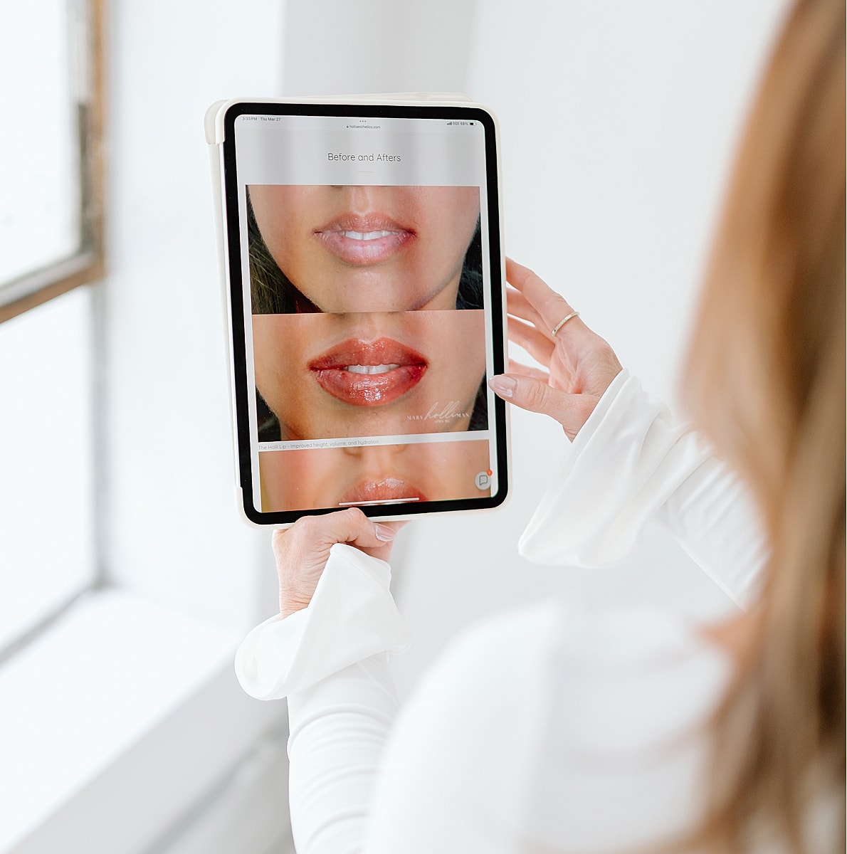 Before and after lip enhancement images on tablet.